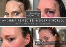 Load image into Gallery viewer, FIRST AID: Wound Repair Ointment