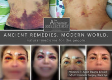 Load image into Gallery viewer, PAIN/FIRST AID: Trauma Salve