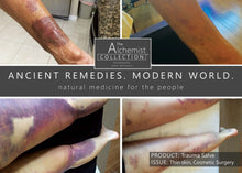 Load image into Gallery viewer, PAIN/FIRST AID: Trauma Salve